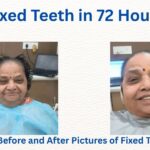 No More Compromised Meals: A Breakthrough in Dental Care Offers Hope to Denture Sufferers