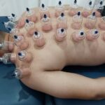 Shoulder Injury Rehabilitation in Noida: How Galena Physiotherapy & Sports Performance Centre Leads Recovery Advances