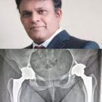 Guarding Against Fractures: A Leading Hip and Knee Surgeon’s Top Tips for Seniors