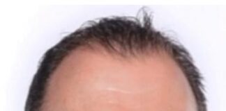 Meet Dr Shaun Segal – Australia’s Leading Skin Cancer Surgeon Dedicated to Innovative Care and Patient-Centered Treatment