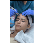 Zolie Skin Clinic: Building a Trusted Reputation in Advanced Dermatology and Aesthetic Care in Delhi