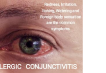 Rising Burden of Allergic Conjunctivitis in India: Need for Early Allergy Evaluation and Awareness