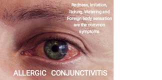 Rising Burden of Allergic Conjunctivitis in India: Need for Early Allergy Evaluation and Awareness