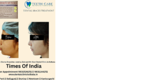 Teeth Care Multispeciality Dental Clinic – Expert Dental Braces, Invisible Aligners & Smile Designing
