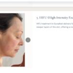 The Best HIFU Treatment in Guwahati: Everything You Need to Know Before You Book