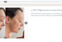 The Best HIFU Treatment in Guwahati: Everything You Need to Know Before You Book